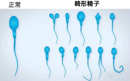 精子畸形率高,会导致胎儿畸形吗?真相可能和你想的不一样