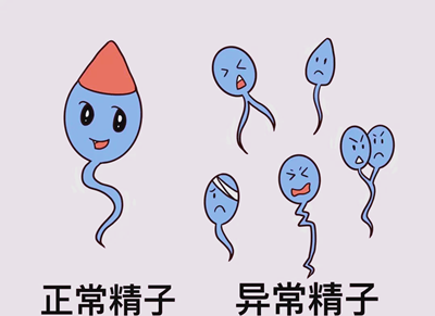 核心检查：精液常规(最关键的&ldquo;成绩单&rdquo;)